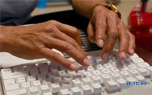 单腿撑起健康梦——记新华网点赞的弥渡县乡村医生李华